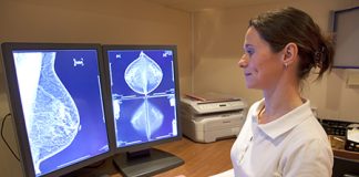 Adesão ao rastreio do cancro da mama abaixo de 23% em Lisboa e Vale do Tejo e Alentejo