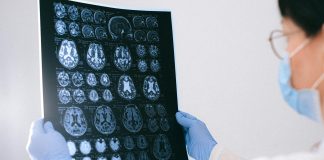 Projeto científico identifica zona no cérebro que pode induzir o envelhecimento